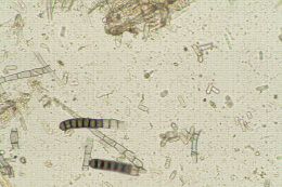 Chlamydospores et phialospores de Thielaviopsis basicola